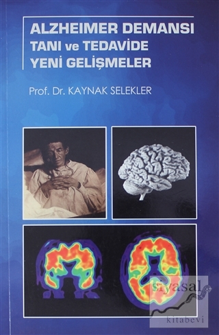 Alzheimer Demansı Tanı ve Tedavide Yeni Gelişmeler Kaynak Selekler