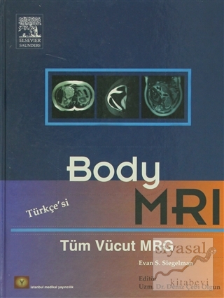 Body MRI (Türkçe Çeviri) (Ciltli) Evan S. Siegelman