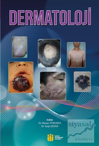 Dermatoloji Dursun Türkmen