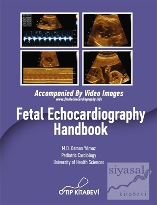 Fetal Echocardiography Handbook (Ciltli) Osman Yılmaz