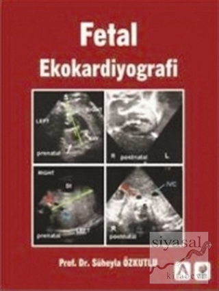 Fetal Ekokardiyografi (Ciltli) Süheyla Özkutlu