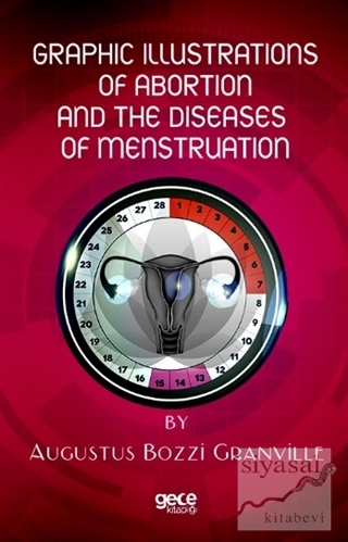 Graphic Illustrations Of Abortion And The Diseases Of Menstruation Aug