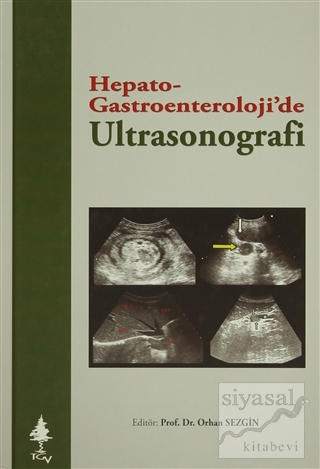 Hepato Gastroenteroloji'de Ultrasonografi (Ciltli) Kolektif