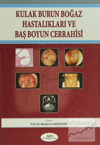 Kulak Burun Boğaz Hastalıkları Baş Boyun Cerrahisi (Ciltli)