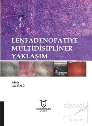 Lenfadenopatiye Multidisipliner Yaklaşım Kolektif