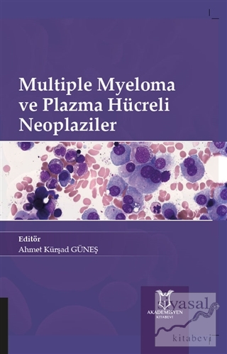 Multiple Myeloma ve Plazma Hücreli Neoplaziler Ahmet Kürşad Güneş