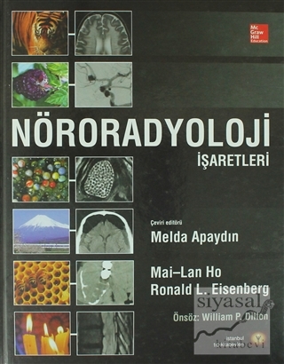 Nöroradyoloji İşaretleri (Ciltli) Mai-Lan Ho