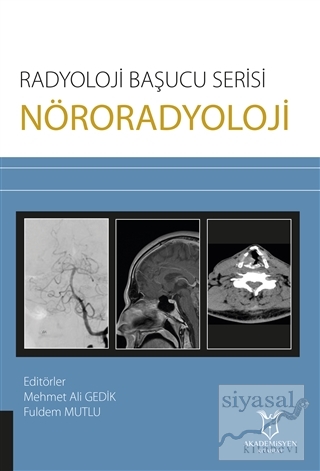 Nöroradyoloji - Radyoloji Başucu Serisi Mehmet Ali Gedik