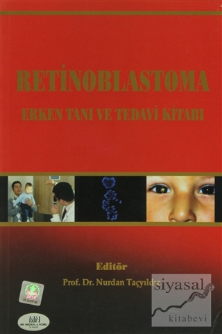 Retinoblastoma Erken Tanı ve Tedavi Kitabı Nurdan Taçyıldız
