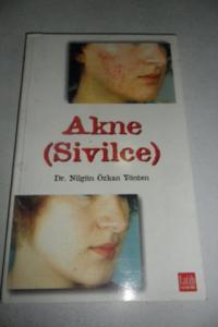 Akne ( Sivilce )