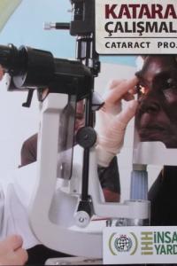 Katarakt Çalışmaları