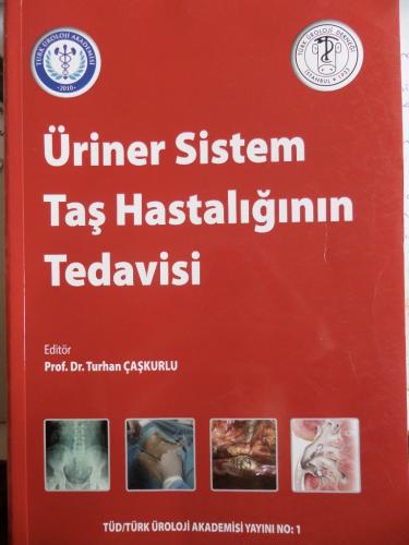 Üriner Sistem Taş Hastalığının Tedavisi Prof. Dr. Turhan Çaşkurlu