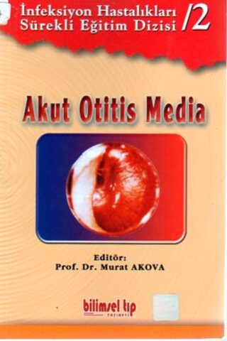 Akut Otitis Media Murat Akova