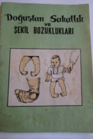 Doğuştan Sakatlık ve Şekil Bozuklukları