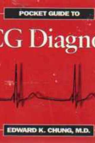 ECG Diagnosis Edward K. Chung