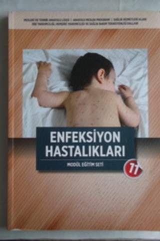 Efeksiyon Hastalıkları / Modül Eğitim Seti 11