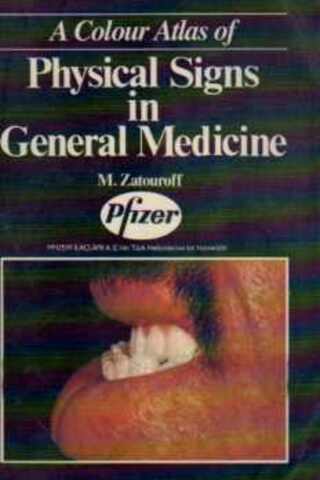 Physical Signs In General Medicine M. Zatouroff