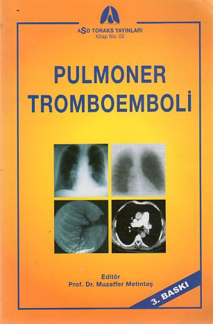 Pulmoner Tromboemboli Muzaffer Metintaş
