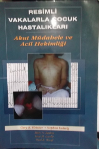 Resimli Vakalarla Çocuk Hastalıkları Akut Müdahale ve Acil Hekimliği G